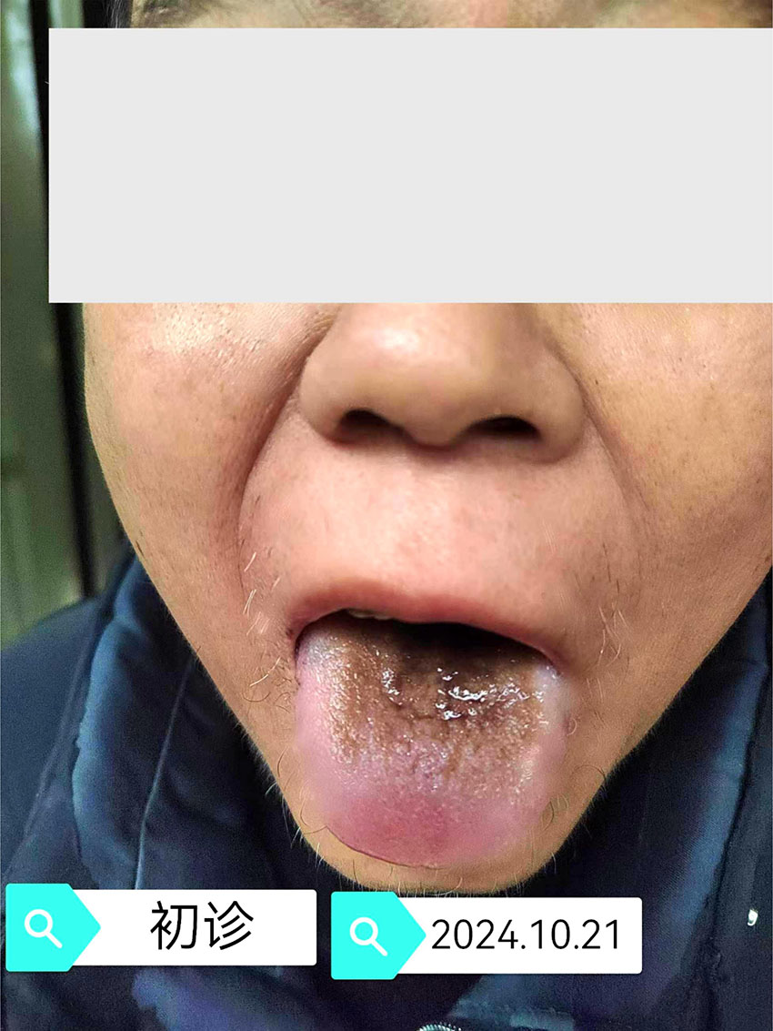 \