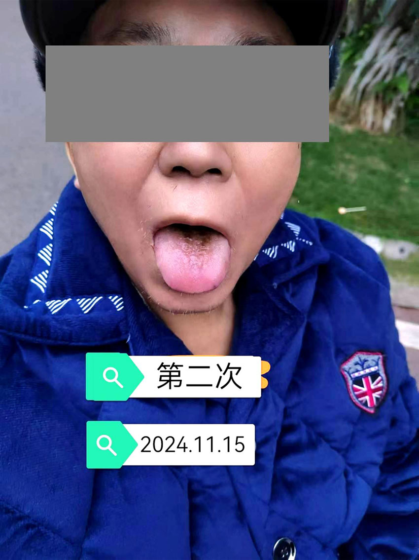 \