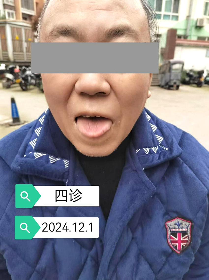 \