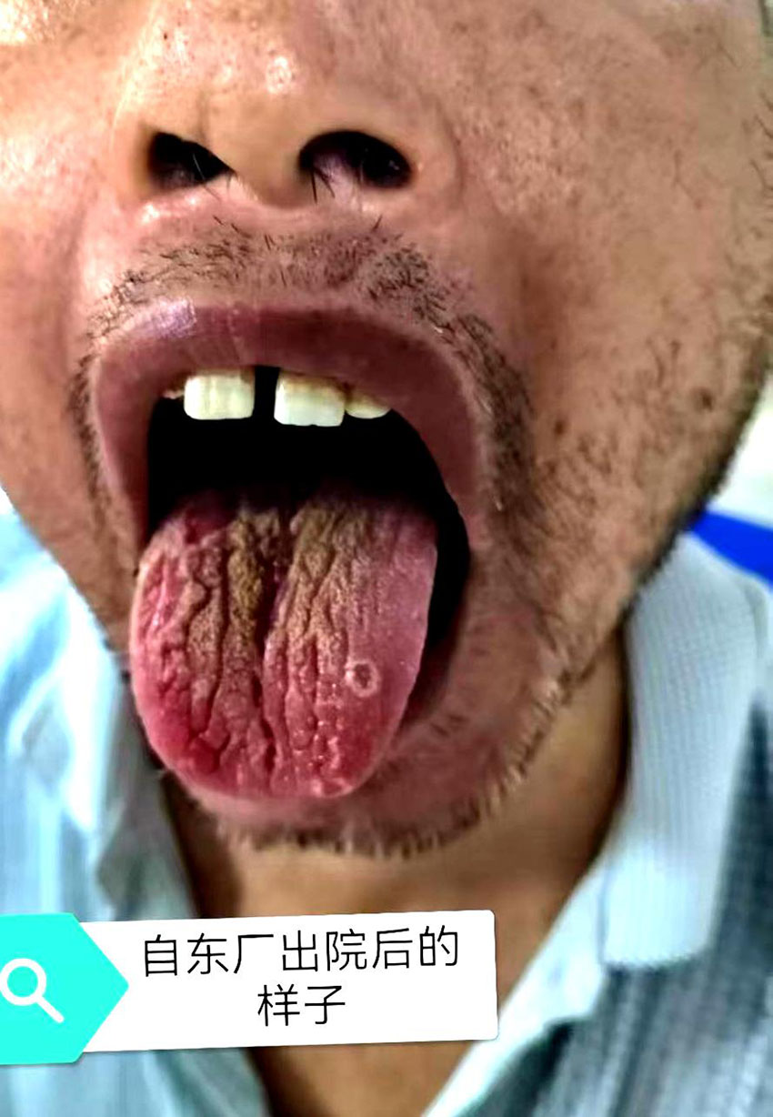 \