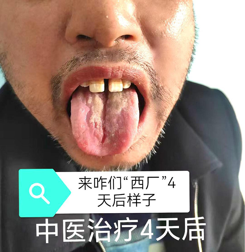 \